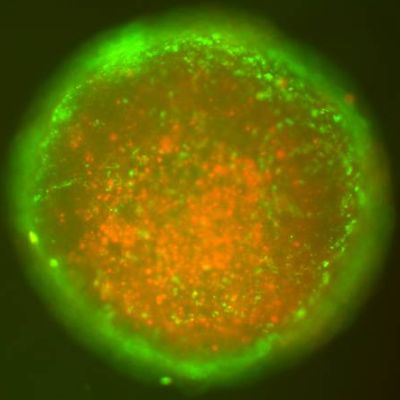 Stained tumor spheroid image showing live and dead cells